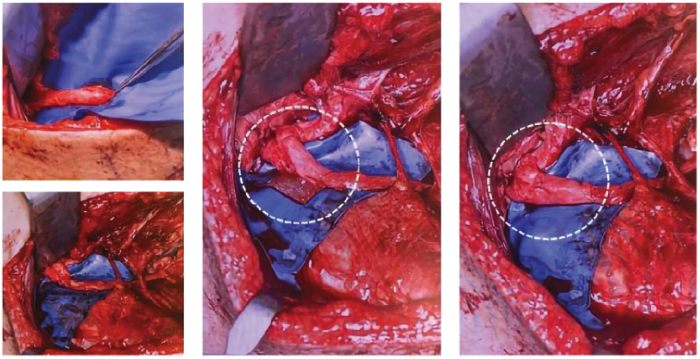 Case Courtesy of Dr Alex O'Beirne