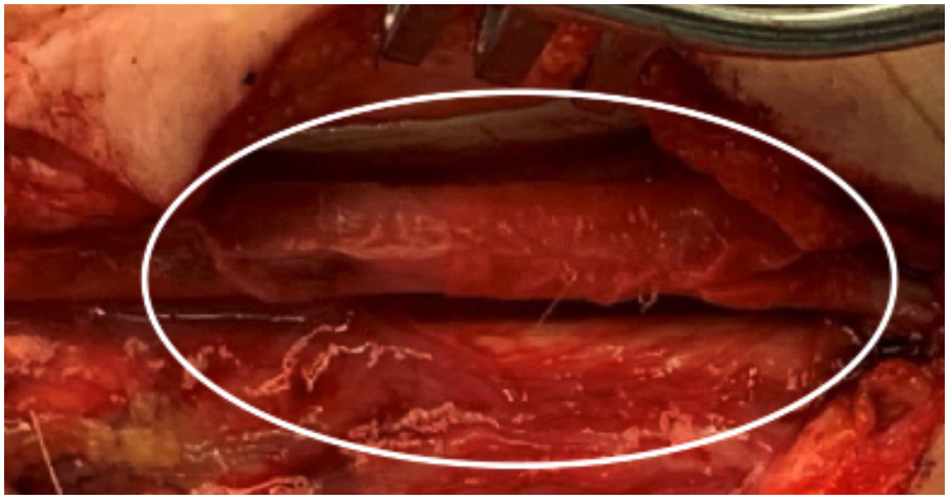 Case Courtesy of Dr Alex O'Beirne