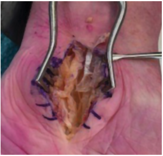 Case Courtesy of Dr Alex O'Beirne