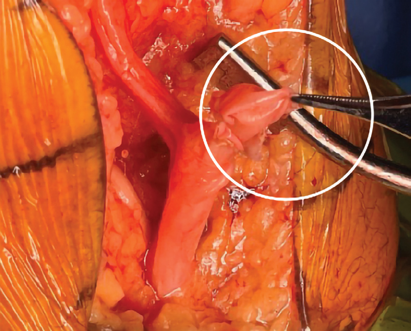 Cases courtesy of Dr David Gamble and Prof Richard Carey Smith