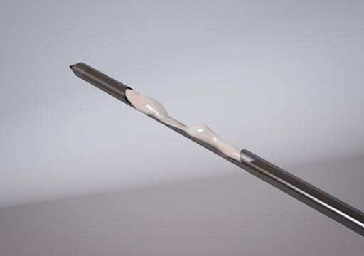Biopsy sample as seen with external
blade retracted