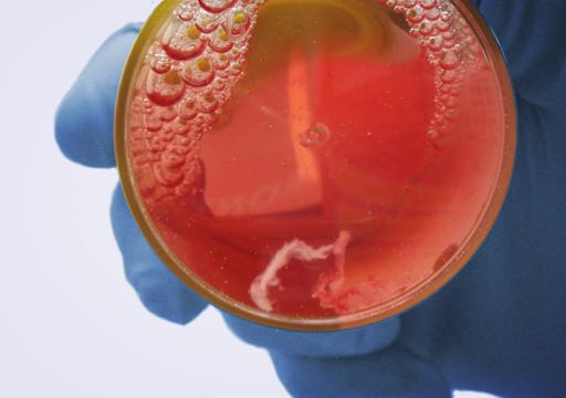 Biopsy within transport medium