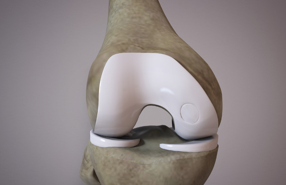 Image 5B
