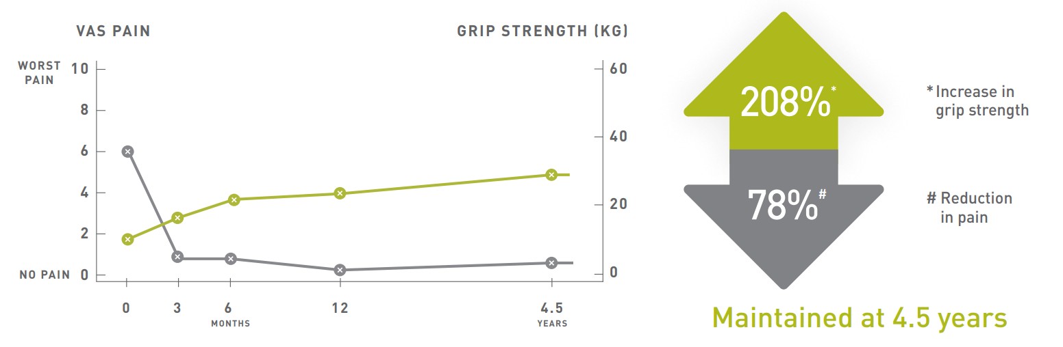 Clinical outcomes chart showing 208% increase in grip strength and 78% reduction in VAS pain scores over 4.5 years following Orthocell treatment, maintained at 4.5 year follow-up