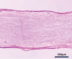 Remplir-wrapped rat sciatic nerve image