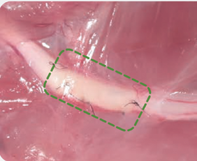 Remplir-wrapped rat sciatic nerve image